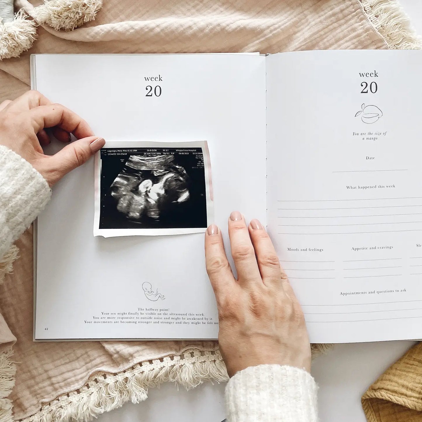 Pregnancy Journal (Jungle) - Parents To Be Record Book Gift
